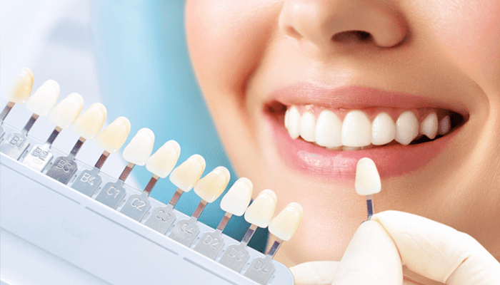 ホワイトニング(歯を白くする治療)
